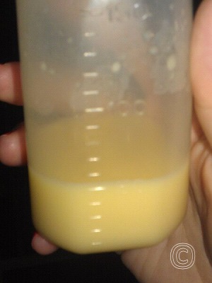 Colostrum, de eerste moedermelk, is meestal vanillegeel van kleur