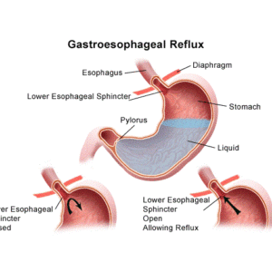 Reflux bij een baby wordt veroorzaakt door een nog onvoldoende ontwikkelde sluitspier